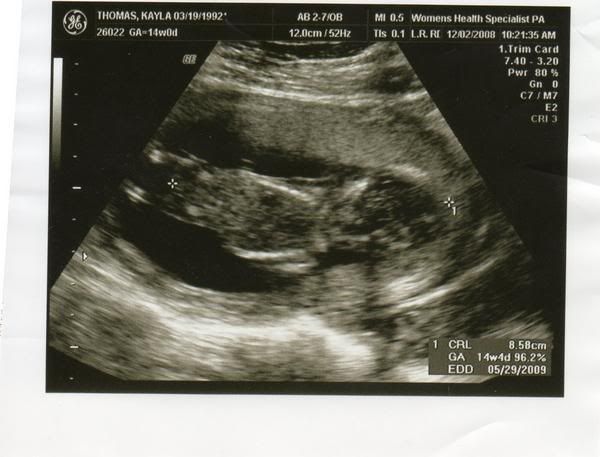 14+weeks+pregnant+ultrasound
