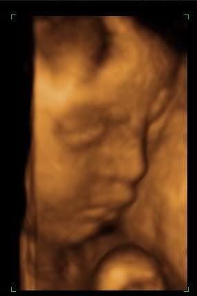 BABY_12-1.jpg